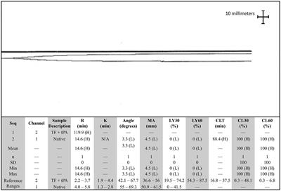 Case report: Chronic disseminated intravascular coagulopathy with concurrent paraneoplastic secondary hyperfibrinolysis in a dog with metastatic nasal adenocarcinoma